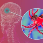 Researchers block key protein that helps Parkinson’s spread through the brain
