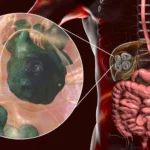 The deadly tapeworm spreading across America has reached the Pacific Northwest