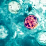 More than 400 sick as CDC searches for the source of a mystery outbreak