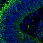 Lab-grown mini brains may predict which Alzheimer’s treatments will work