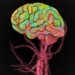 Immune cells flood into the aging brain, Stanford scientists discover